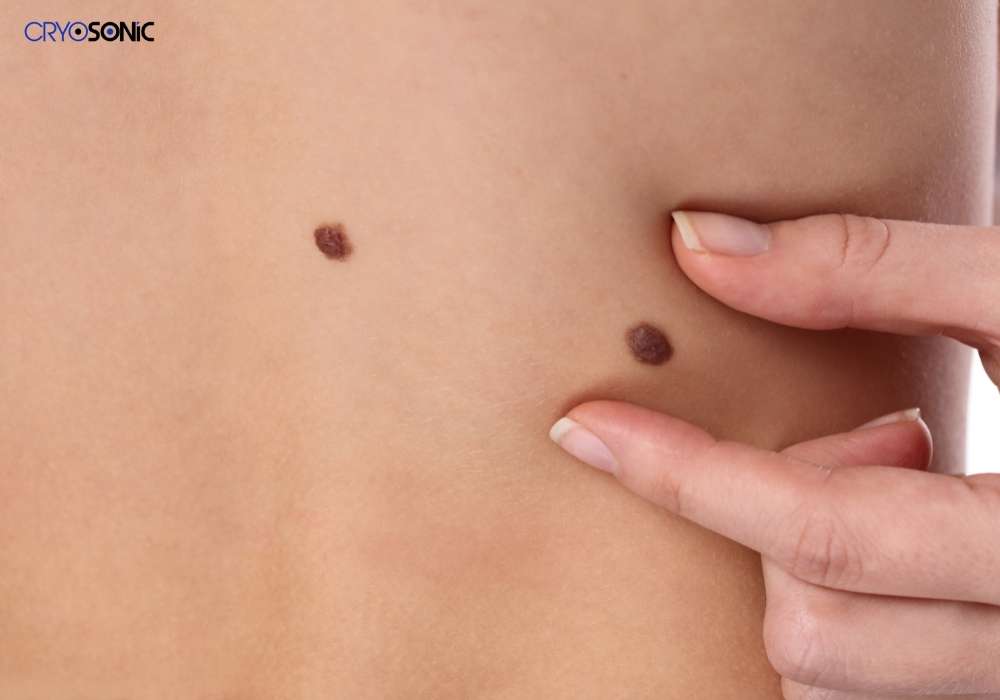 Infection Risk and Poor Aftercare Eccles