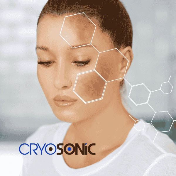 Are you looking for age spot removal treatment? Contact Cryosonic today in Eccles