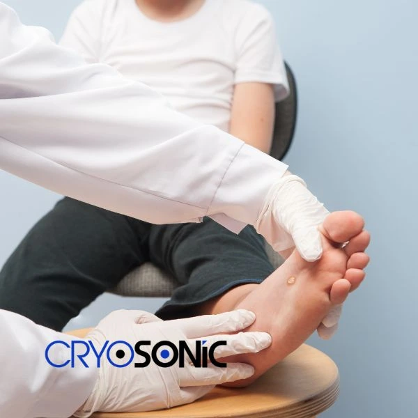 Are you looking for fast effective wart removal Contact us today Eccles